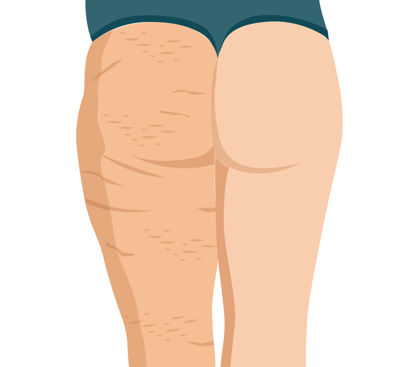 Piernas estilizadas