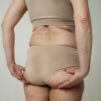 Cómo eliminar la celulitis sin cirugía